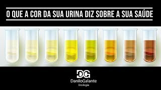 O QUE A COR DA SUA URINA DIZ SOBRE A SUA SAÚDE  INFECÇÃO URINÁRIA [upl. by Aieki]