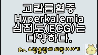 고칼륨혈증Hyperkalemia 칼륨 농도별 심전도ECG 변화 tall T wave tenting T 방실차단 등 [upl. by Corsetti]