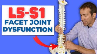 How to Fix L5S1 Facet Joint Dysfunction Without Surgery  Dr Marc Dupuis Chiropractor  Sanford ME [upl. by Irem]