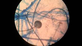 Rhizopus [upl. by Dianna]