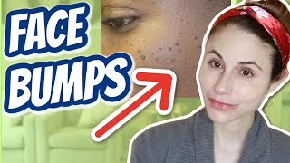 How to get rid of bumps on the face Dr Dray [upl. by Daniala]