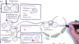 Systemic Lupus Erythematosus SLE  signs and symptoms pathophysiology investigations treatment [upl. by Wycoff]