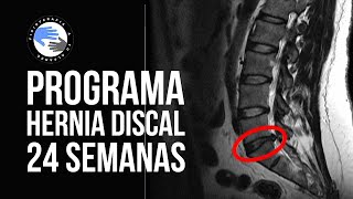 Programa de ejercicios para hernia discal de 24 semanas de duracion [upl. by Led]