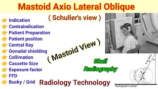 Mastoid Axio Lateral Oblique view  Schullers View in Hindi  Mastoid View [upl. by Cown]