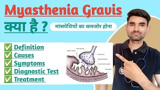 Myasthenia Gravis in Hindi  Causes Symptoms And Treatment of Myasthenia Gravis [upl. by Ahsilyt139]