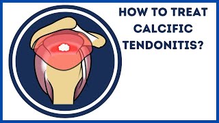 How to treat calcific tendonitis [upl. by Adyahs]