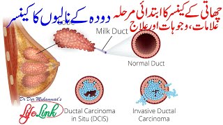 Ductal Carcinoma in Situ DCIS  Successful Natural Treatment of Breast Cancer [upl. by Anaehs]