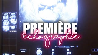 LA PREMIÈRE ÉCHOGRAPHIE PREMIER TRIMESTRE  VLOG GROSSESSE [upl. by Sybila556]