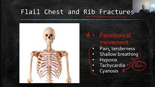 Chest Trauma [upl. by Anilef]