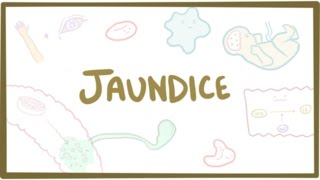 Jaundice  causes treatment amp pathology [upl. by Anniken]