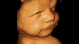 28 Weeks Pregnancy Anatomy Scan  4D Ultrasound  Knowing The Gender of my Baby [upl. by Aiden]