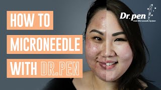 How to microneedle at home with Dr Pen  Dr Pen Australia  Microneedling  Skin Needling  CIT [upl. by Aralomo]