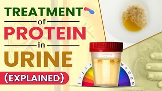 Treatment Of Protein In Urine Explained [upl. by Brogle508]