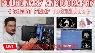 Pulmonary Angiography smart prep technique Live CT Scan  pulmonary angio scanning process [upl. by Laemsi]