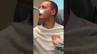 Septoplasty and Turbinate Reduction Splint Removal [upl. by Jairia]