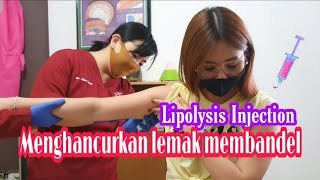 Treatment penghancur lemak Lipolysis Injection [upl. by Agnizn]