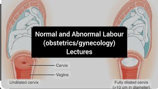 Abnormal labour Cephalopelvic disproportion part 1 causessignscomplications  obstetrics lecture9 [upl. by Artenal]