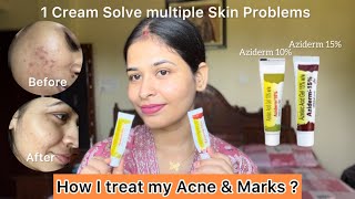 How to use Azelaic Acid correctly  Honest Review  All in One Cream [upl. by Dasie]