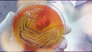 Xylose Lysine Deoxycholate agar  XLD  Selective medium for Salmonella and Shigella [upl. by Melessa458]