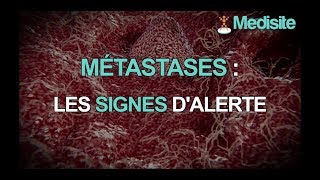 Métastases  les signes dalerte [upl. by Lougheed]