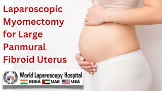 Laparoscopic Myomectomy for Large Panmural Fibroid Uterus An Ideal Surgical Approach [upl. by Enivid]