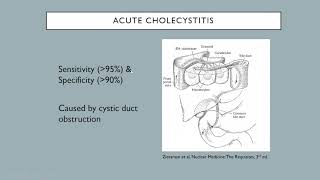 Nuclear medicine hepatobiliary liver and spleen [upl. by Leacim]