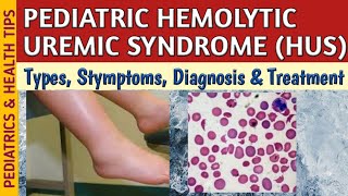 Hemolytic Uremic Syndrome HUS Symptoms Diagnosis amp Treatment In Children [upl. by Suryc162]