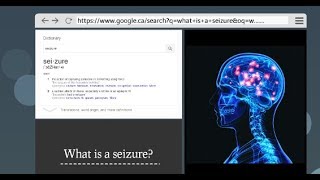 What Are Seizures and How to Recognize Them [upl. by Wendin]