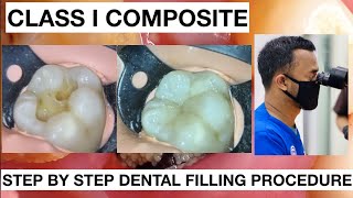 Step by Step Dental Filling Procedure  General Dentist Griya RR [upl. by Hayyifas536]