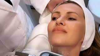 Exilis Skin Tightening for the Décolleté area [upl. by Durware613]