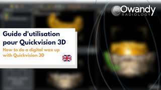 7 How to do a digital wax up with Quickvision 3D [upl. by Cooke]