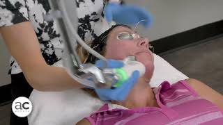 Halo Treatment Demo at AesthetiCare [upl. by Oretos]