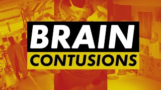 Contusion  traumatic brain injury explained [upl. by Aicat712]