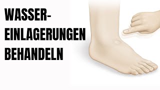 So behandelst du Wassereinlagerungen in den Beinen [upl. by Analim]