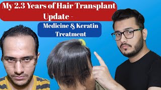 My 23 years hair transplant result  Keratin Treatment  Finasteride amp Minoxidil Update  The Alpha [upl. by Darius]