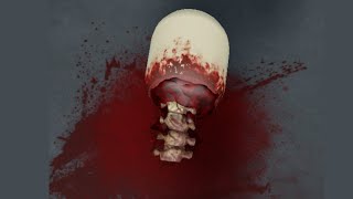 Roblox Blood and Gore Games [upl. by Tommy]