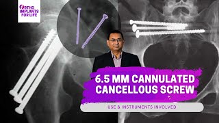 65mm Cannulated Cancellous Screws Related Instruments amp Uses [upl. by Fabi]