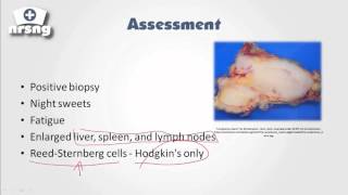 Lymphoma NCLEX® Review  NRSNGacademycom [upl. by Newra222]