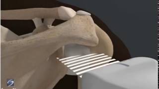 How To Shoulder Glenohumeral Joint 3D Video [upl. by Enitsuga]