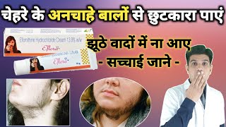 Eflornithine hydrochloride cream  eflora cream for facial hair  eflora cream how to use [upl. by Babbie]