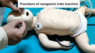 Nasogastric feeding Tube insertion  Ryles Tube  Pediatrics Instruments [upl. by Enahs225]