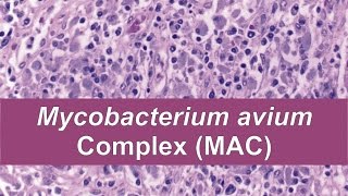 Mycobacterium avium complex MAC [upl. by Anekahs]