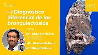 Diagnóstico diferencial de las bronquiectasias por el Dr Aldo Pacheco [upl. by Mosi]