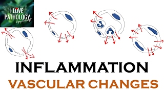 INFLAMMATION Part 1 General concepts types  Vascular changes in Acute inflammation [upl. by Langill]