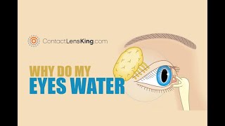 Why Do My Eyes Water What Causes My Eyes to Water [upl. by Ilatfan]