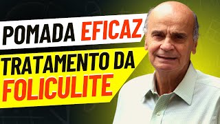 Pomada para foliculite Conheça o MELHOR tratamento [upl. by Lizzy100]