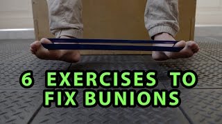 6 Exercises to Fix Bunions [upl. by Sander]