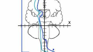 NeuroLogic Exam Videos  Sensory Exam [upl. by Anotyad]