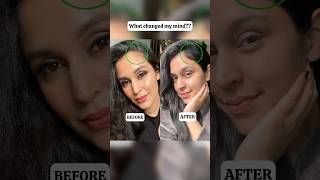 Why I stopped using Rosemary Oil hairgrowth haircaretips hairfallcontrol [upl. by Bikales512]