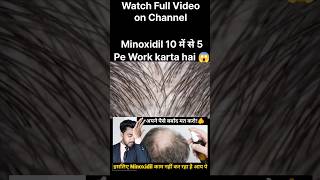 Minoxidil 10 में से 5 Pe kaam karta hai😱trendingshorts hairfall haircare minoxidil viralreels [upl. by Aikehs]